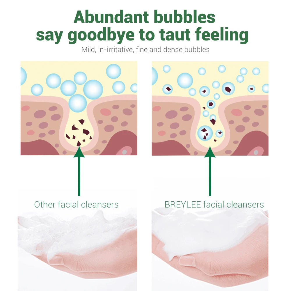 BREYLEE Facial Cleanser Acne Treatment Face Cleansing Wash Mask Skin Care Cleaner Shrink Pore Oil Control Remove Blackhead