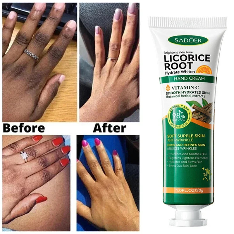 Fast Brighten Dark Knuckles Cream Whiting Hand Cream Lighten Melanin Stains Corrector Hand Anti Crack Soften Moisturize Product