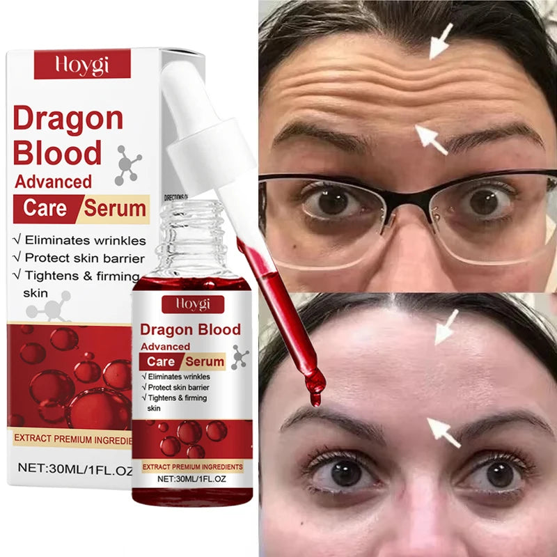 Dragon Blood Advanced Serum Effective Resist Aging Tighten Skin Reduce Wrinkles Brighten Skin Tone Improve Dullness Face Essence